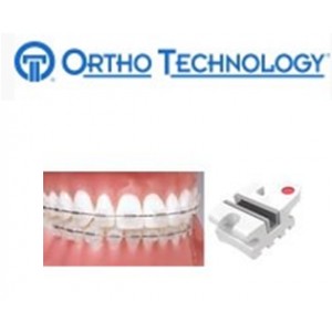 Ortho Technology Brackets – Aesthetic / Avalon Metal Lined Composite Bracket System