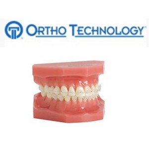 Ortho Technology Brackets – Aesthetic / Orthoflex Composite Bracket System