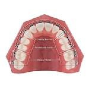 Ortho Technology Wire Products / Trifecta Thermal Niti Archwire