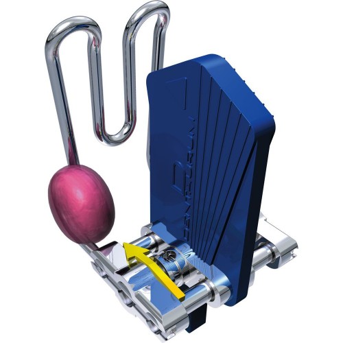 Guide Ridge For “Flexible” Forward Thrust Double Plate System Acc. To Schaneng With Palatal Expansion Screw - 1 piece