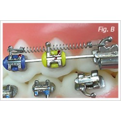 p-item-1-hover