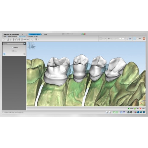 Maestro 3D Dental Studio - Dental CAD / Dental Restoration (dental restoration module)