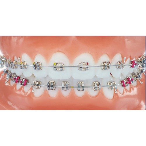 Weldable Brackets Medium/Mini - Legend 