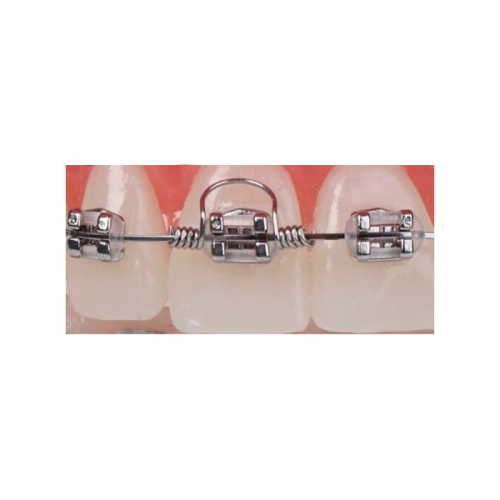 Orthodontic Torquing Coil Springs 10 pcs
